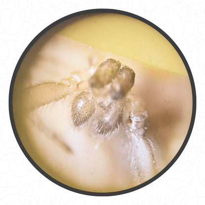 The Original Miniscope™